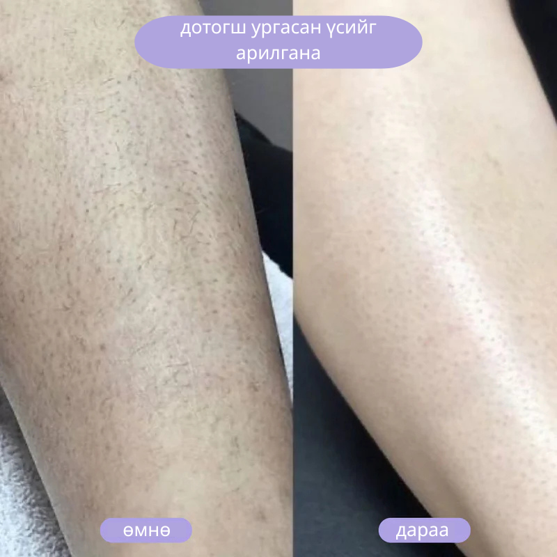 Кристал үс арилгагч